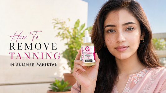 How To Remove Tanning In Summer Pakistan (2026 Guide)